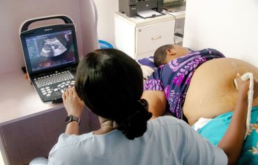 Ultrasound Scan
