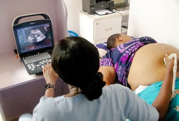 Ultrasound Scan